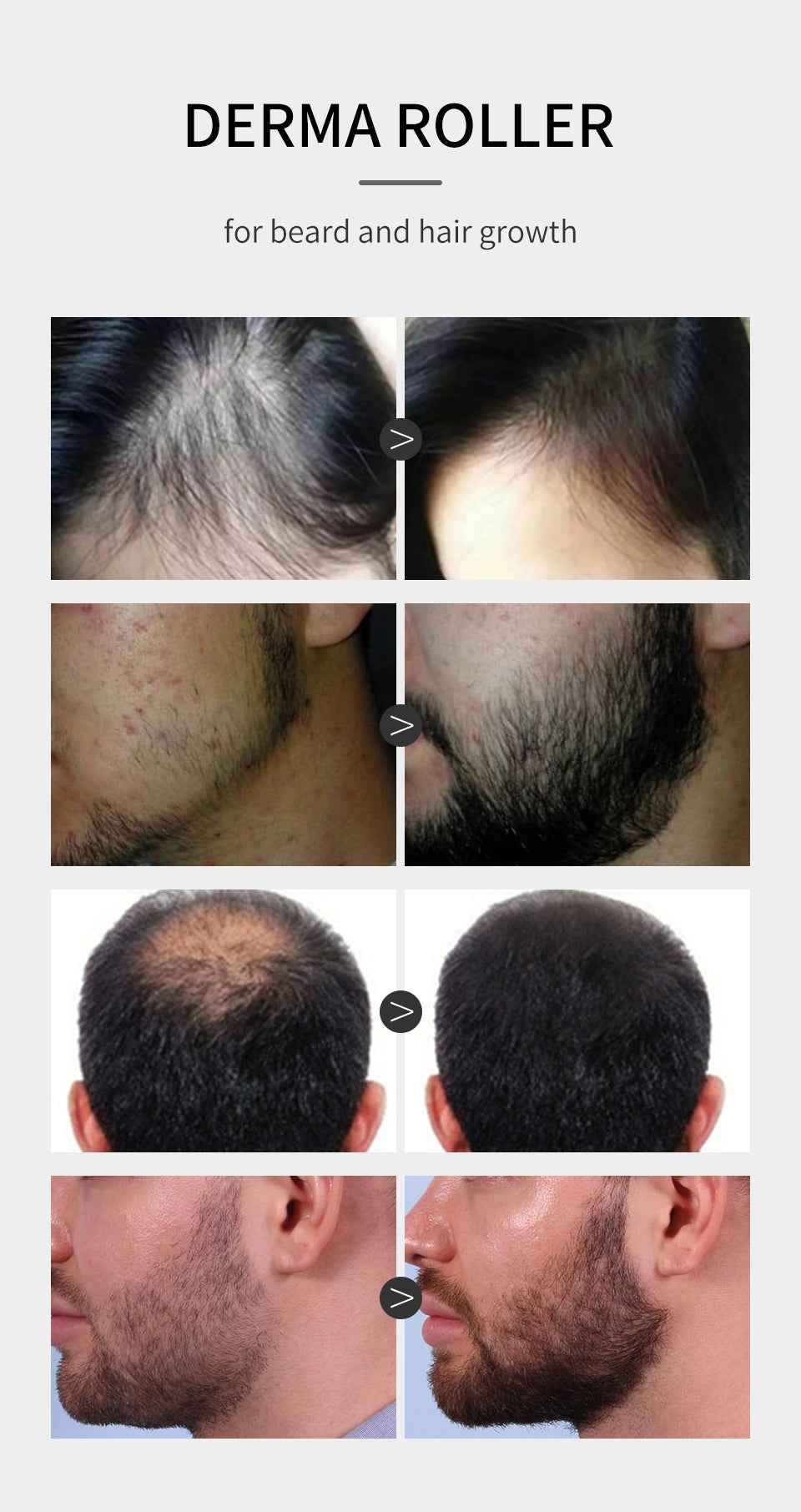 SEVICH Hair Growth Essence Spray - BD Drop